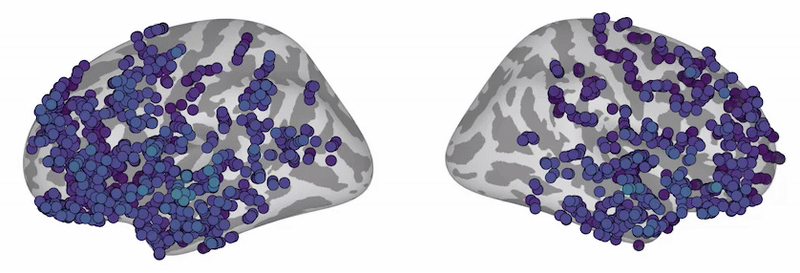 Brain Activity Animation